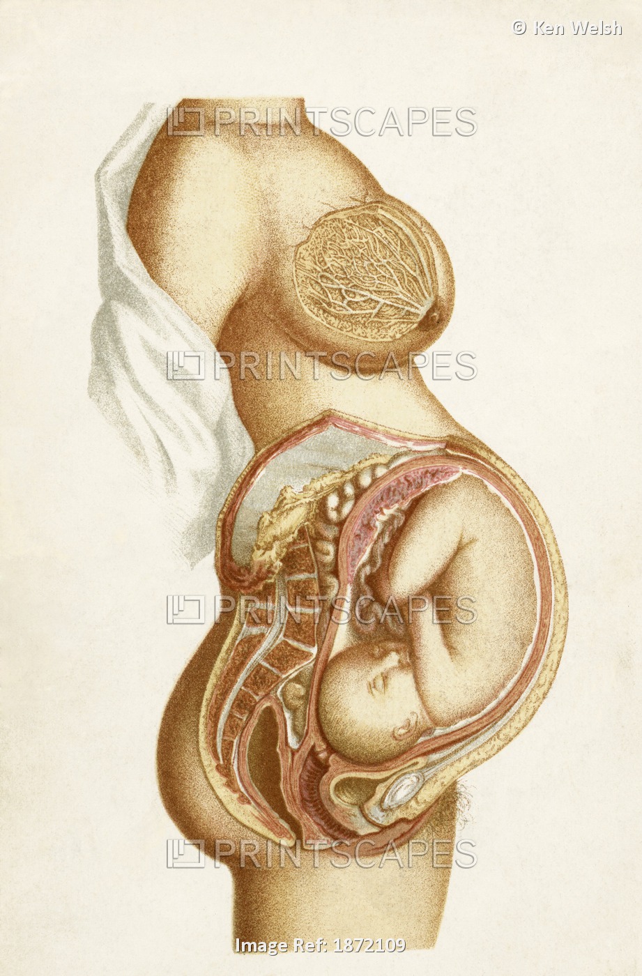 Semi-Diagrammatic Section Of A Full Time Pregnancy Showing Position Of Foetus ...