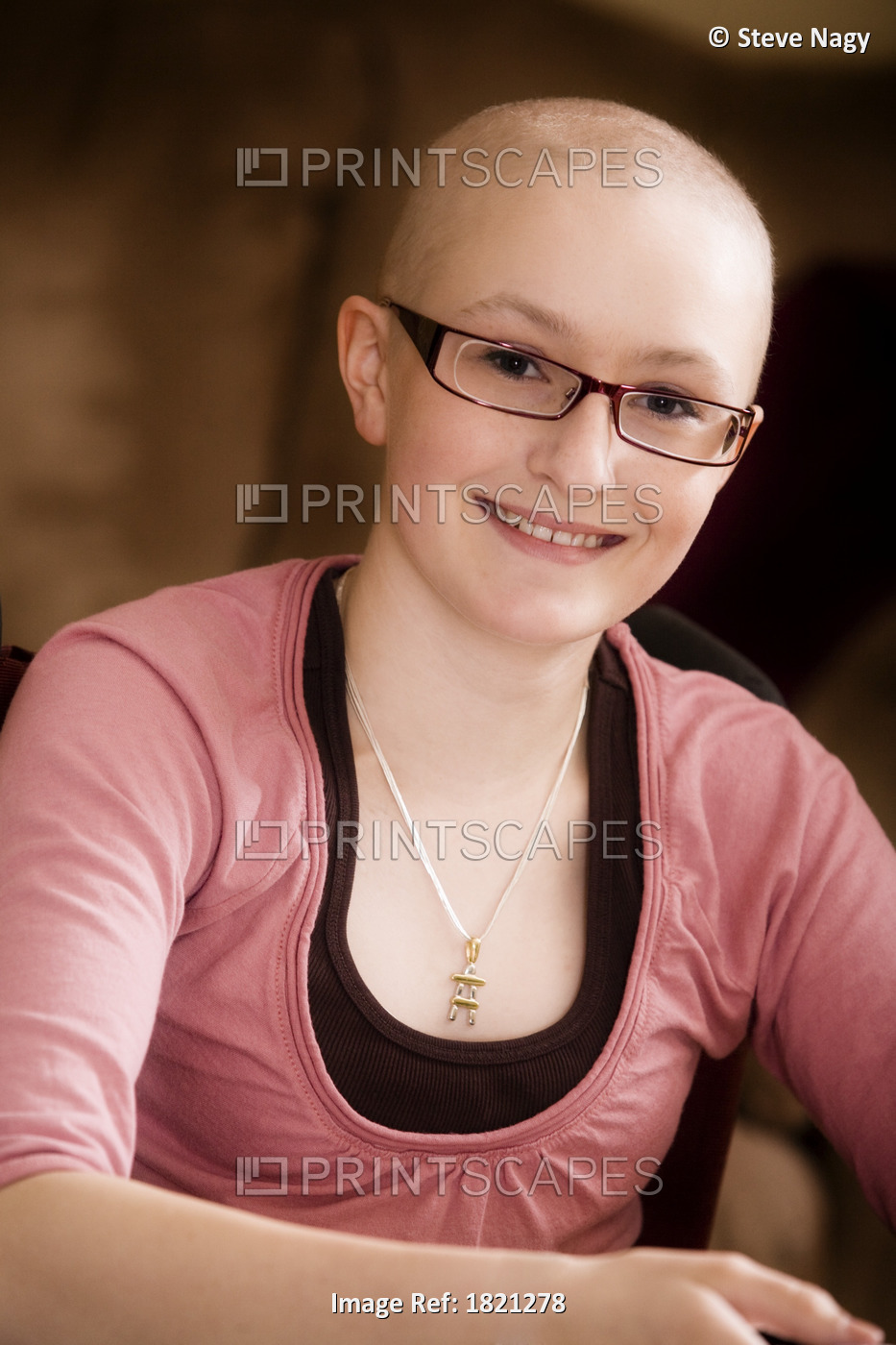 Portrait of a girl with hair loss from cancer treatments