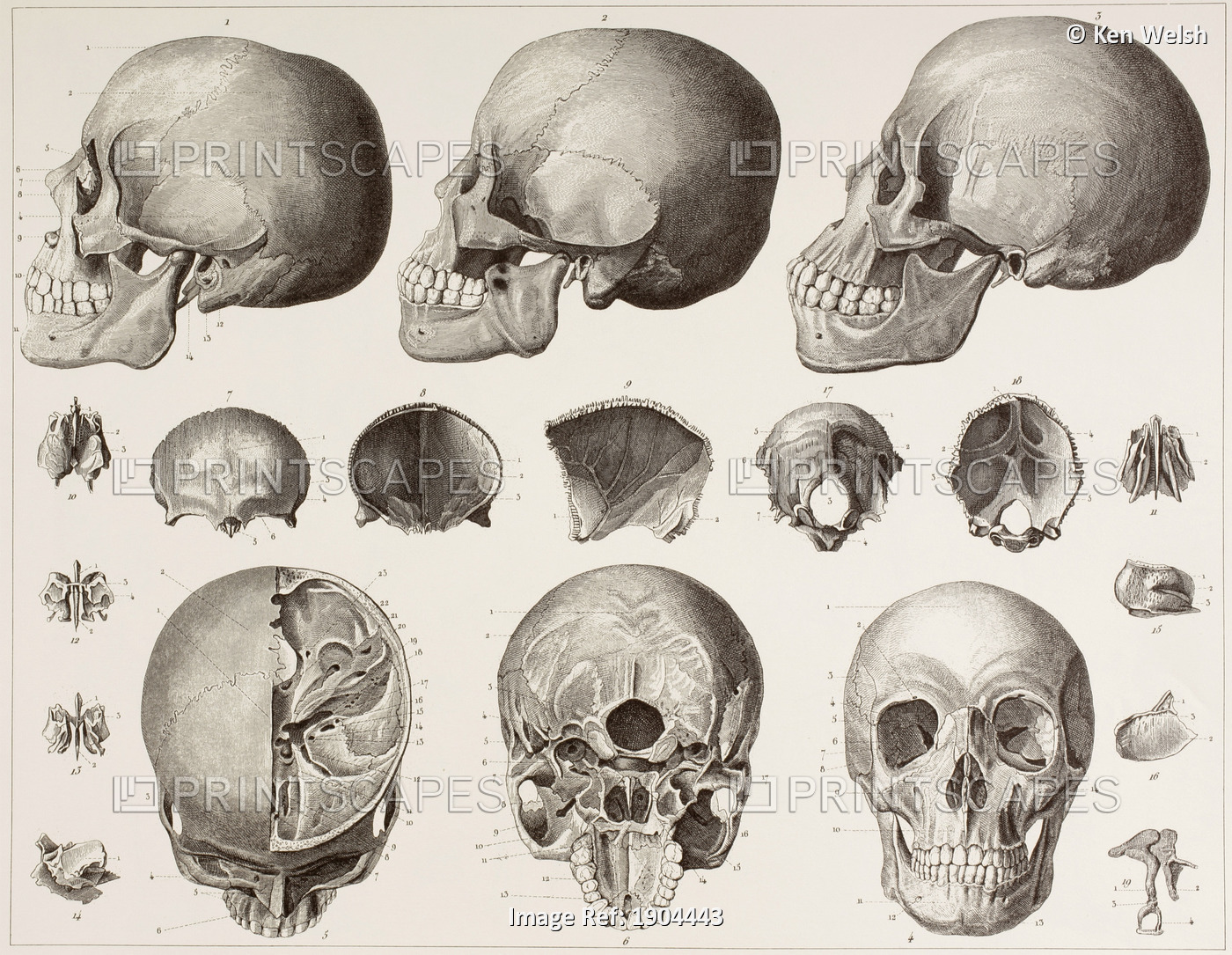 Bones Of The Head. After A 19Th Century Print.