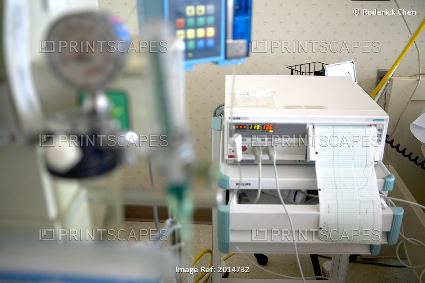 Intravenous And Contraction Machines In Hospital Room