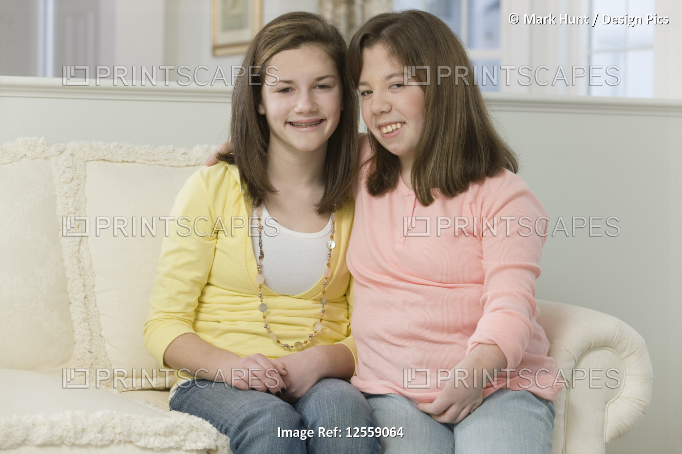 Two teenage girls sitting together, one with birth defect