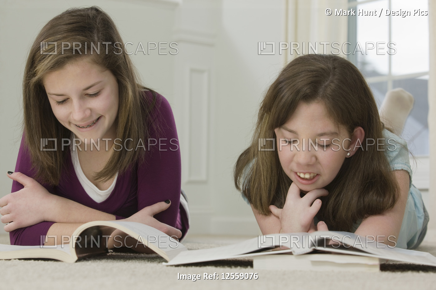 Two teenage girls studying together, one with birth defect