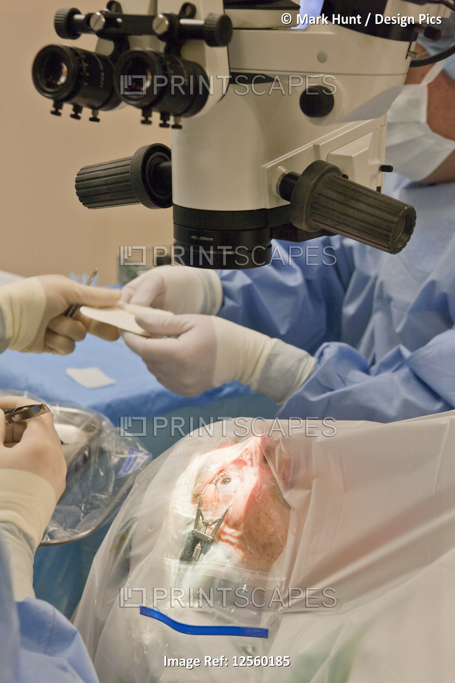 Surgical technologist passing suture to doctor for cataract surgery