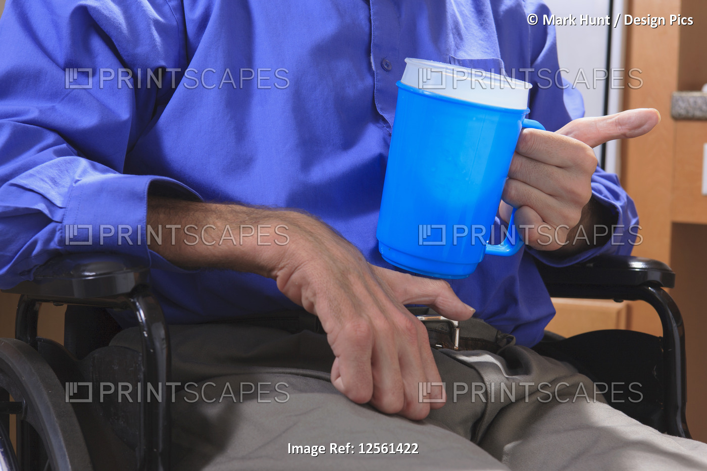 Man with Friedreich's Ataxia holding a cup of water with his deformed hands