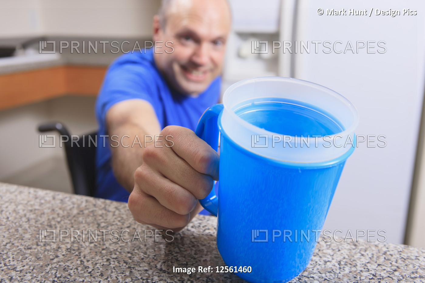 Man with Friedreich's Ataxia holding a cup of water with his deformed hands