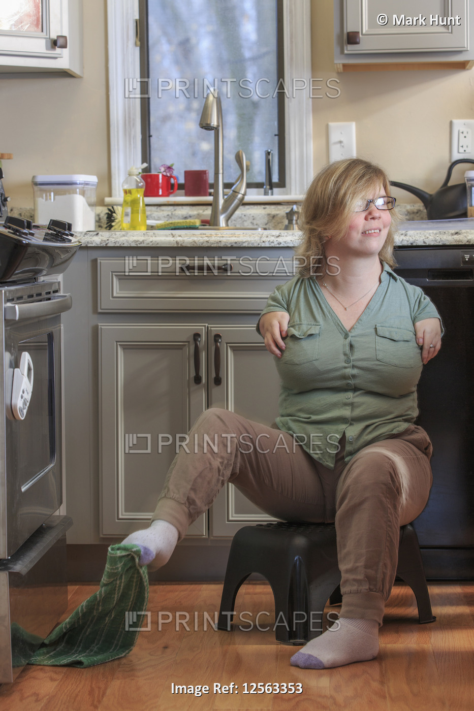 Woman with TAR Syndrome picking up a kitchen towel with her feet