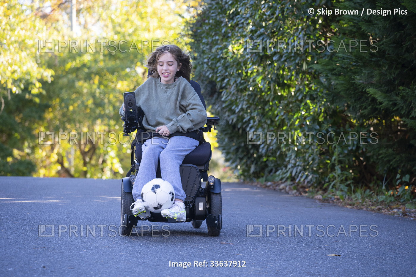 Eleven year old girl with Ullrich Congenital Muscular Dystrophy plays soccer in ...