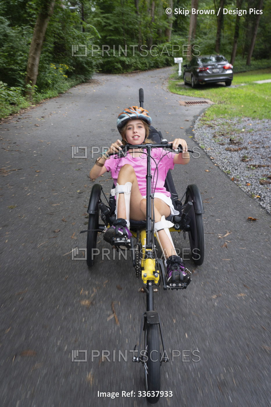 Girl with Ullrich Congenital Muscular Dystrophy riding her recumbent trike ...